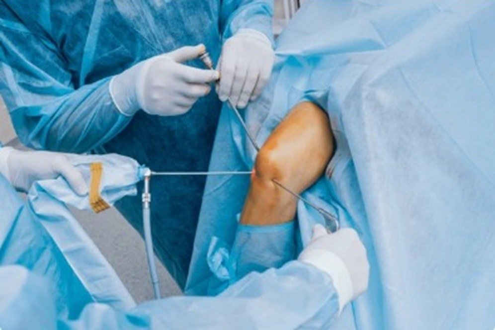 Advanced arthroscopic surgeries